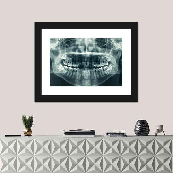 Dental X-Ray Canvas Wall Art-3 Horizontal-Gallery Wrap-25&quot; x 16&quot;-Tiaracle
