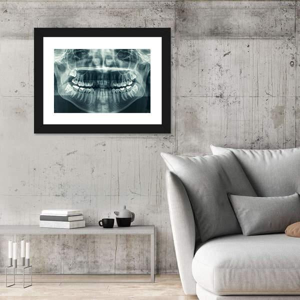 Dental X-Ray Canvas Wall Art-3 Horizontal-Gallery Wrap-25&quot; x 16&quot;-Tiaracle