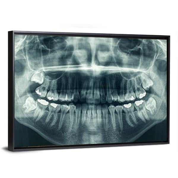 Dental X-Ray Canvas Wall Art-3 Horizontal-Gallery Wrap-25&quot; x 16&quot;-Tiaracle