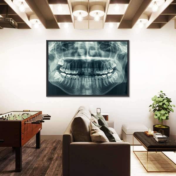 Dental X-Ray Canvas Wall Art-3 Horizontal-Gallery Wrap-25&quot; x 16&quot;-Tiaracle