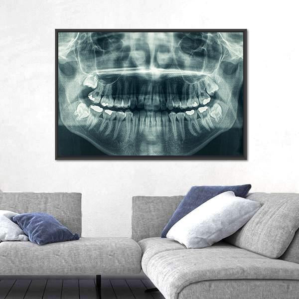 Dental X-Ray Canvas Wall Art-1 Piece-Floating Frame-24" x 16"-Tiaracle