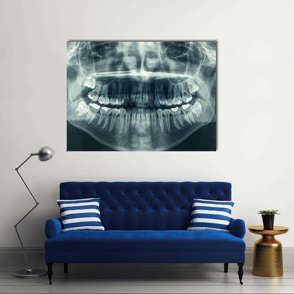 Dental X-ray Canvas Wall Art in black, white and gray, single panel hung on a wall