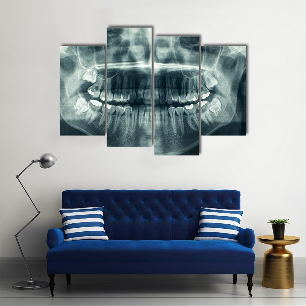 Dental X-Ray Canvas Wall Art-4 Pop-Gallery Wrap-50&quot; x 32&quot;-Tiaracle