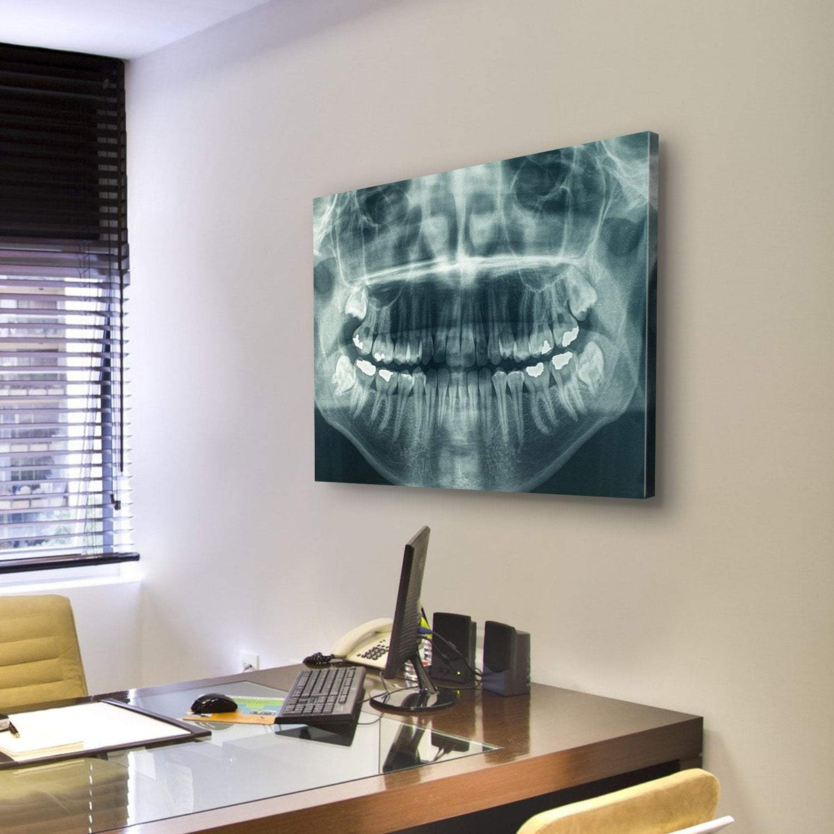 Dental X-Ray Canvas Wall Art-3 Horizontal-Gallery Wrap-25&quot; x 16&quot;-Tiaracle