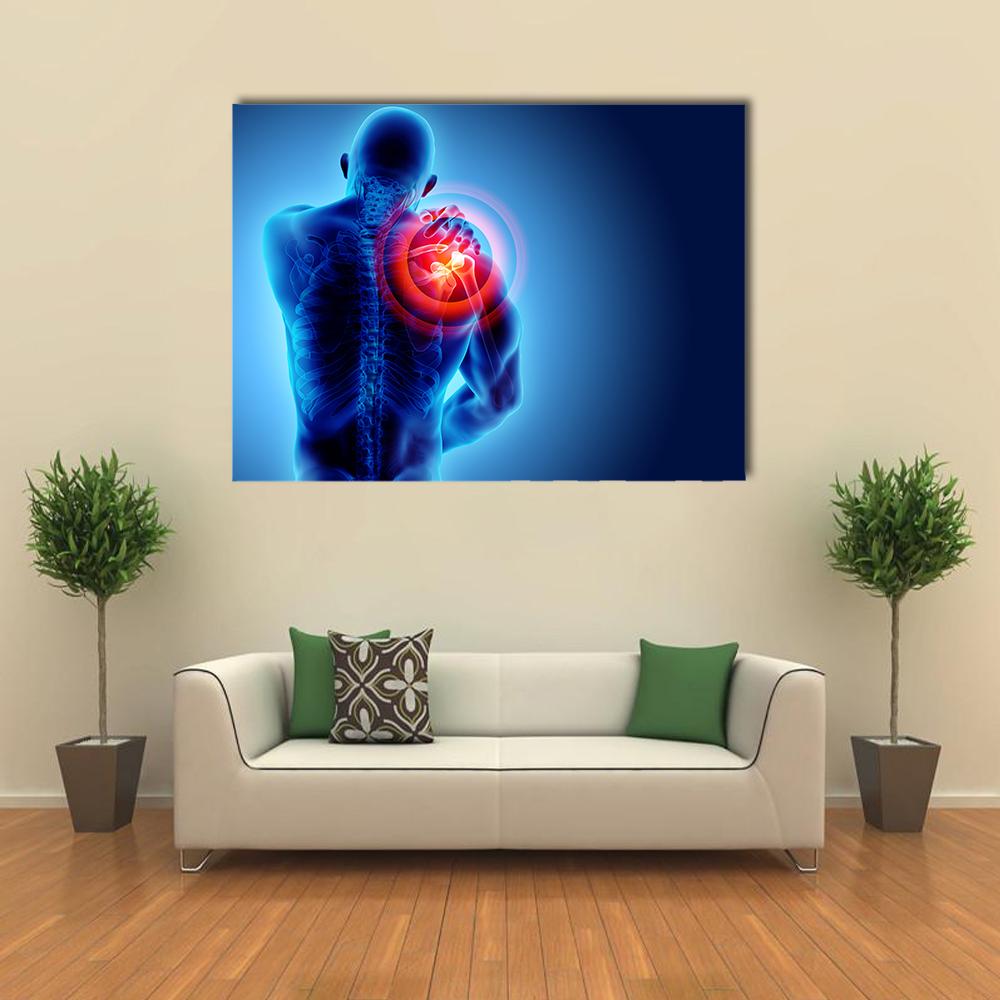 Shoulder Pain Skeleton X-ray Illustration Canvas Wall Art in black, red and blue, single panel hung on a wall