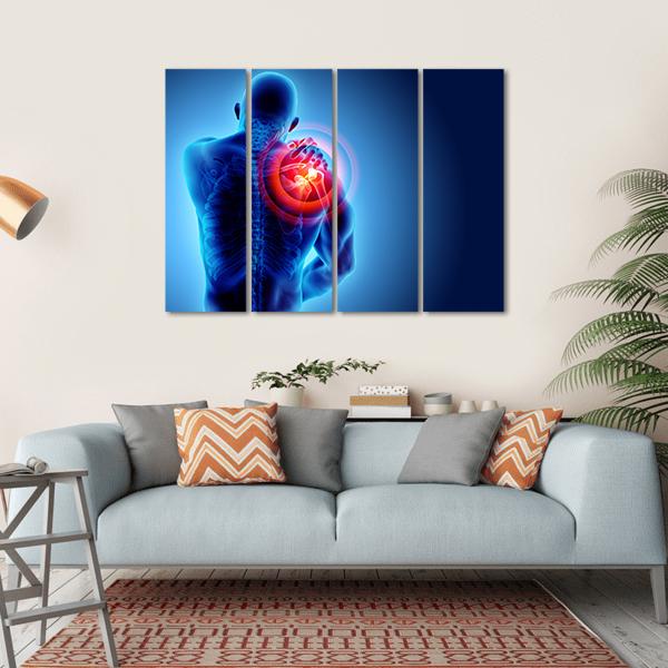 Shoulder Pain Skeleton X-ray Illustration Canvas Wall Art in black, red and blue, hung on a wall