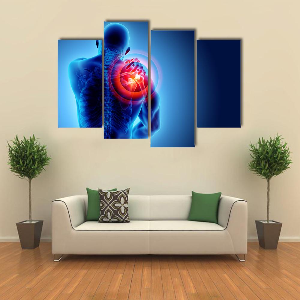 Shoulder Painful Skeleton X-Ray Canvas Wall Art-4 Pop-Gallery Wrap-34" x 20"-Tiaracle