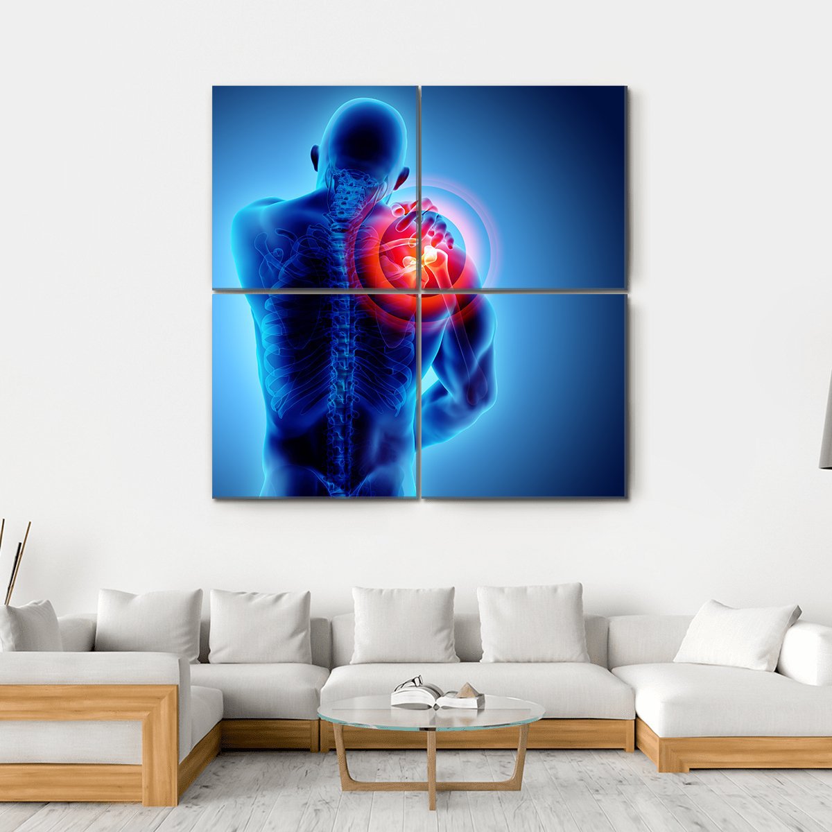 Shoulder Painful Skeleton X-Ray Canvas Wall Art-4 Square-Gallery Wrap-17" x 17"-Tiaracle