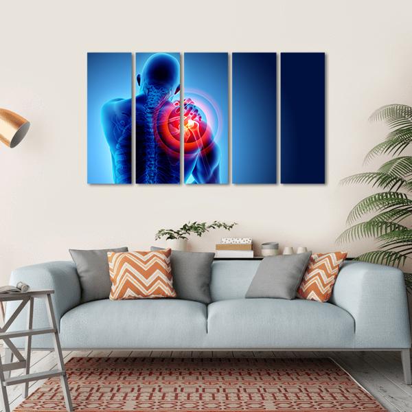 Shoulder Painful Skeleton X-Ray Canvas Wall Art-5 Horizontal-Gallery Wrap-22" x 12"-Tiaracle