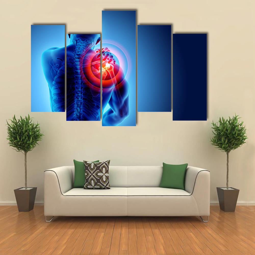 Shoulder Painful Skeleton X-Ray Canvas Wall Art-5 Pop-Gallery Wrap-32" x 21"-Tiaracle