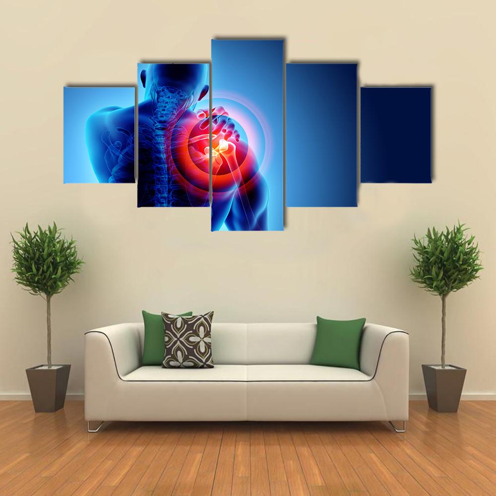 Shoulder Painful Skeleton X-Ray Canvas Wall Art-5 Star-Gallery Wrap-42" x 21"-Tiaracle