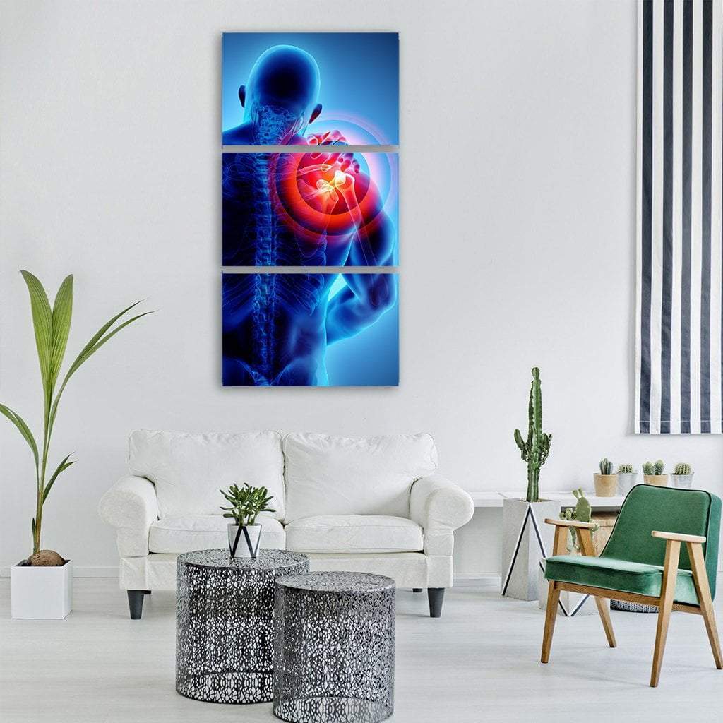 Shoulder Painful Skeleton X-Ray Illustration Vertical Canvas Wall Art-3 Vertical-Gallery Wrap-12" x 25"-Tiaracle