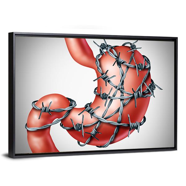 Stomach Pain Canvas Wall Art-3 Horizontal-Gallery Wrap-25" x 16"-Tiaracle