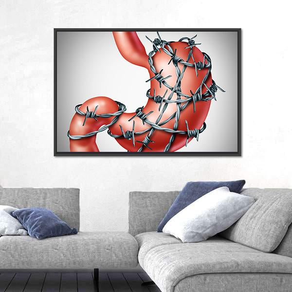 Stomach Pain Canvas Wall Art-3 Horizontal-Gallery Wrap-25" x 16"-Tiaracle