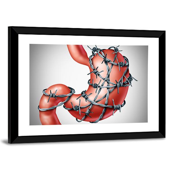 Stomach Pain Canvas Wall Art-3 Horizontal-Gallery Wrap-25" x 16"-Tiaracle