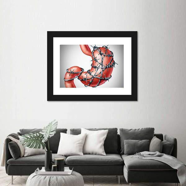 Stomach Pain Canvas Wall Art-3 Horizontal-Gallery Wrap-25" x 16"-Tiaracle