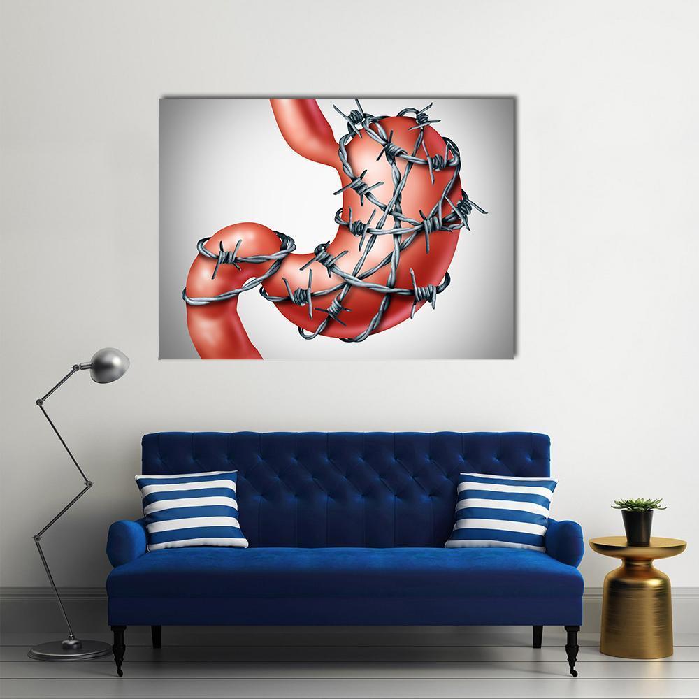 Human Stomach Wrapped in Barbed Wire Canvas Wall Art in gray, silver and red, single panel hung on a wall