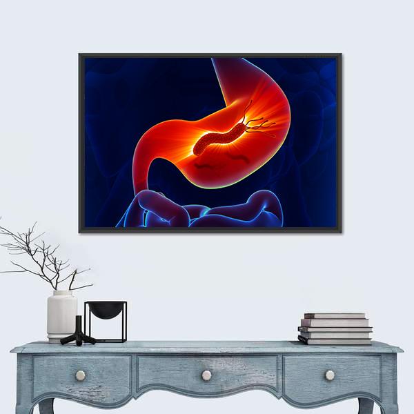 View Of Stomach Canvas Wall Art-1 Piece-Floating Frame-24&quot; x 16&quot;-Tiaracle