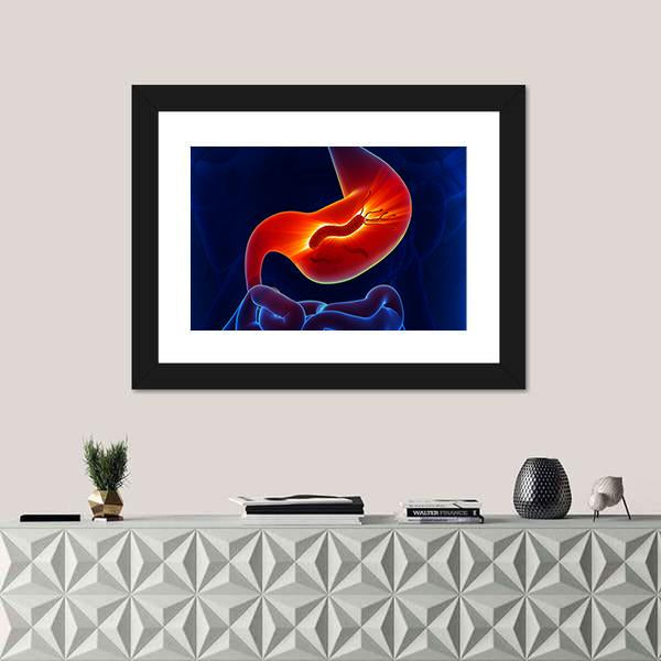 View Of Stomach Canvas Wall Art-1 Piece-Framed Print-20" x 16"-Tiaracle