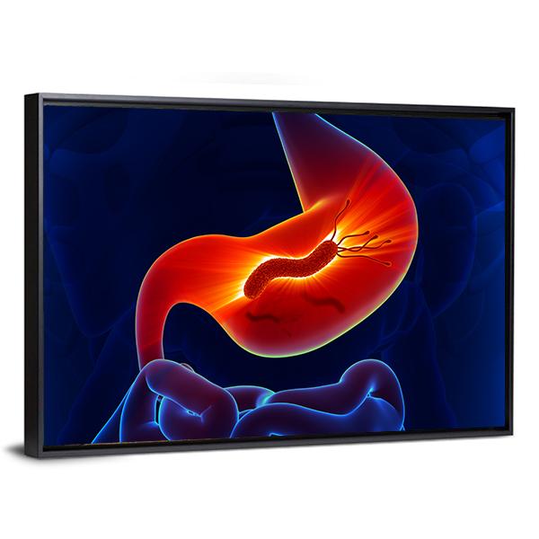 View Of Stomach Canvas Wall Art-3 Horizontal-Gallery Wrap-25" x 16"-Tiaracle
