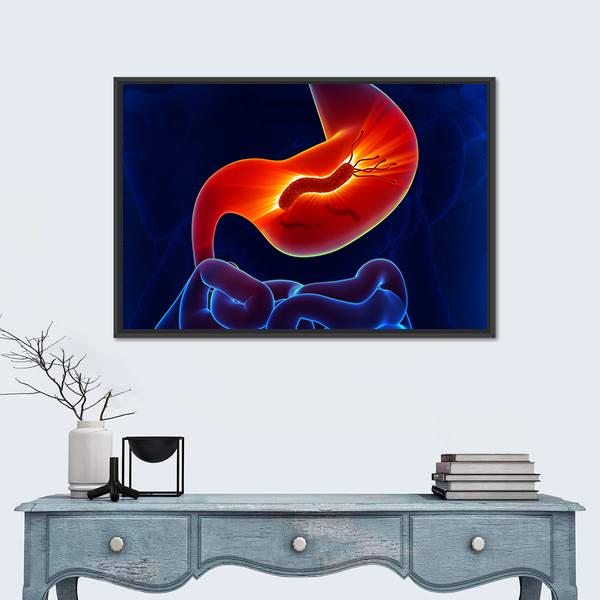 View Of Stomach Canvas Wall Art-1 Piece-Floating Frame-24" x 16"-Tiaracle