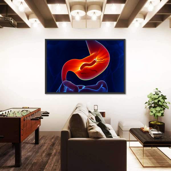 View Of Stomach Canvas Wall Art-5 Horizontal-Gallery Wrap-22&quot; x 12&quot;-Tiaracle