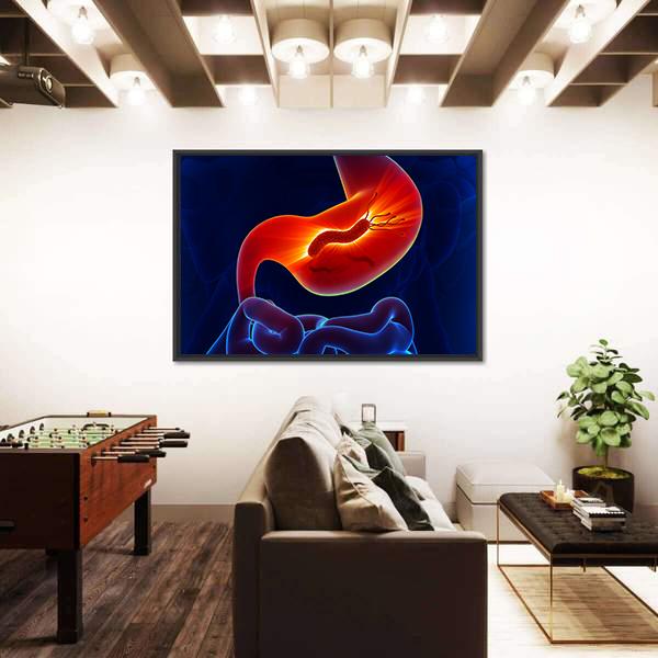 View Of Stomach Canvas Wall Art-3 Horizontal-Gallery Wrap-25" x 16"-Tiaracle