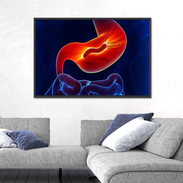 View Of Stomach Canvas Wall Art-3 Horizontal-Gallery Wrap-25" x 16"-Tiaracle