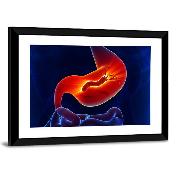 View Of Stomach Canvas Wall Art-3 Horizontal-Gallery Wrap-25" x 16"-Tiaracle