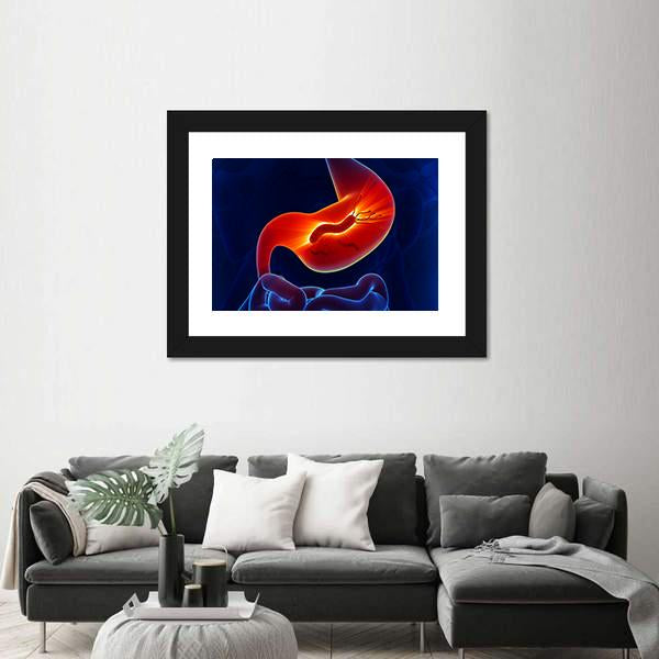 View Of Stomach Canvas Wall Art-5 Horizontal-Gallery Wrap-22" x 12"-Tiaracle