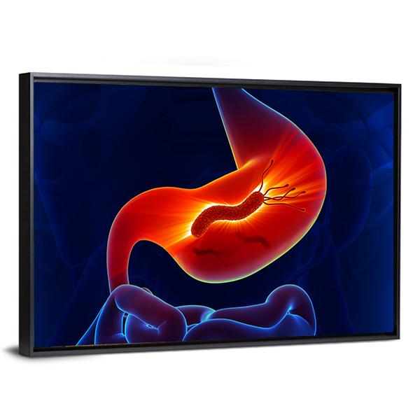 View Of Stomach Canvas Wall Art-5 Horizontal-Gallery Wrap-22&quot; x 12&quot;-Tiaracle