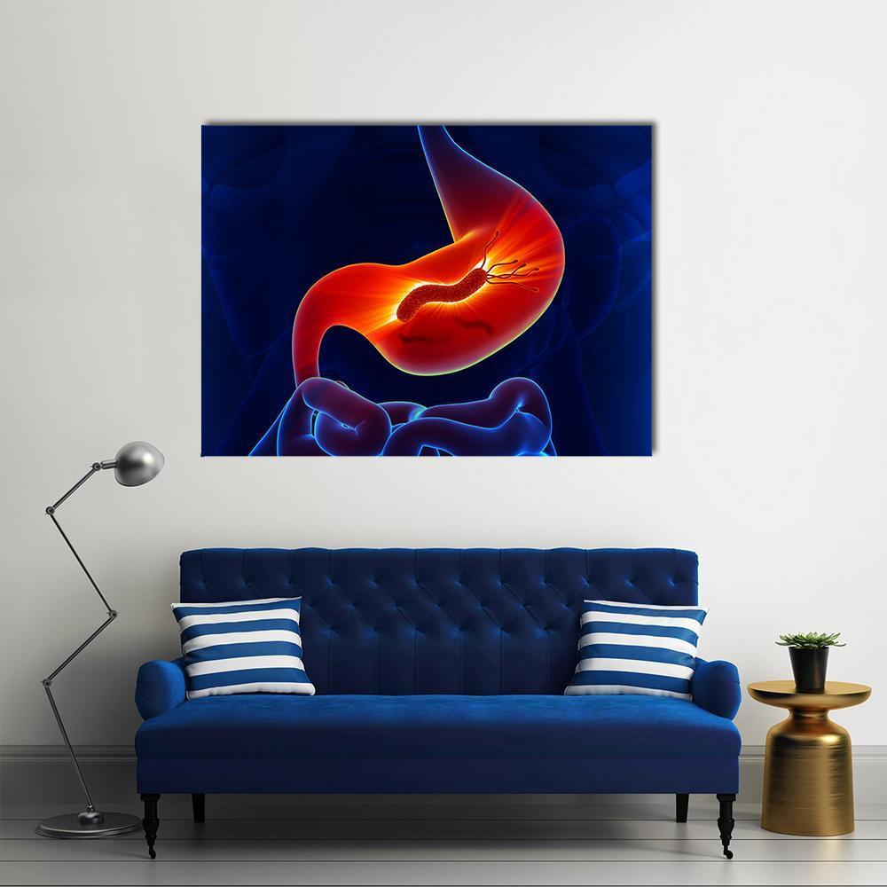 View Of Stomach Canvas Wall Art-4 Horizontal-Gallery Wrap-34" x 24"-Tiaracle
