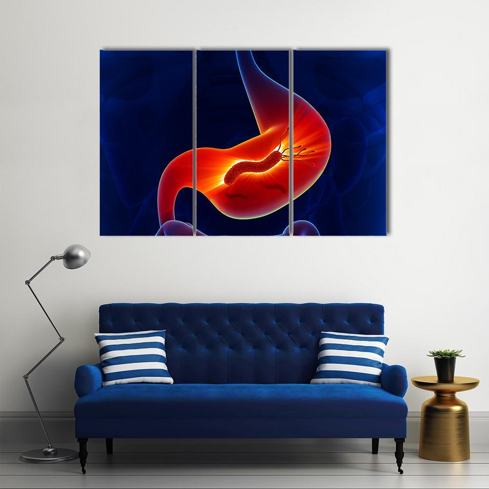View Of Stomach Canvas Wall Art-3 Horizontal-Gallery Wrap-37" x 24"-Tiaracle