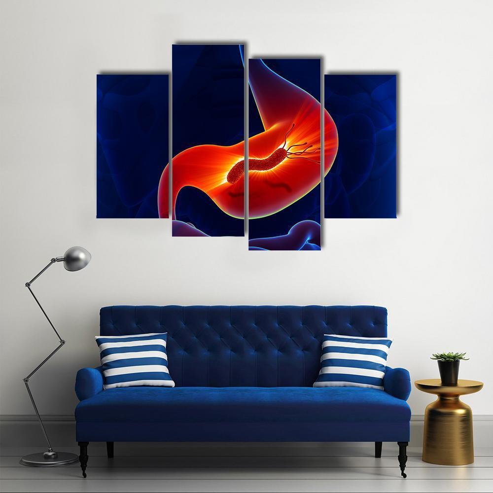 View Of Stomach Canvas Wall Art-4 Pop-Gallery Wrap-50" x 32"-Tiaracle