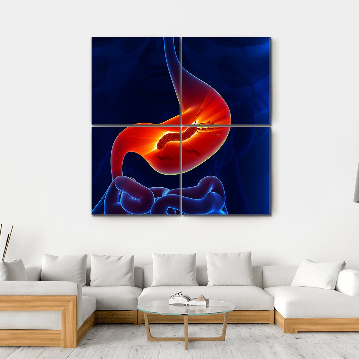 View Of Stomach Canvas Wall Art-4 Square-Gallery Wrap-17" x 17"-Tiaracle