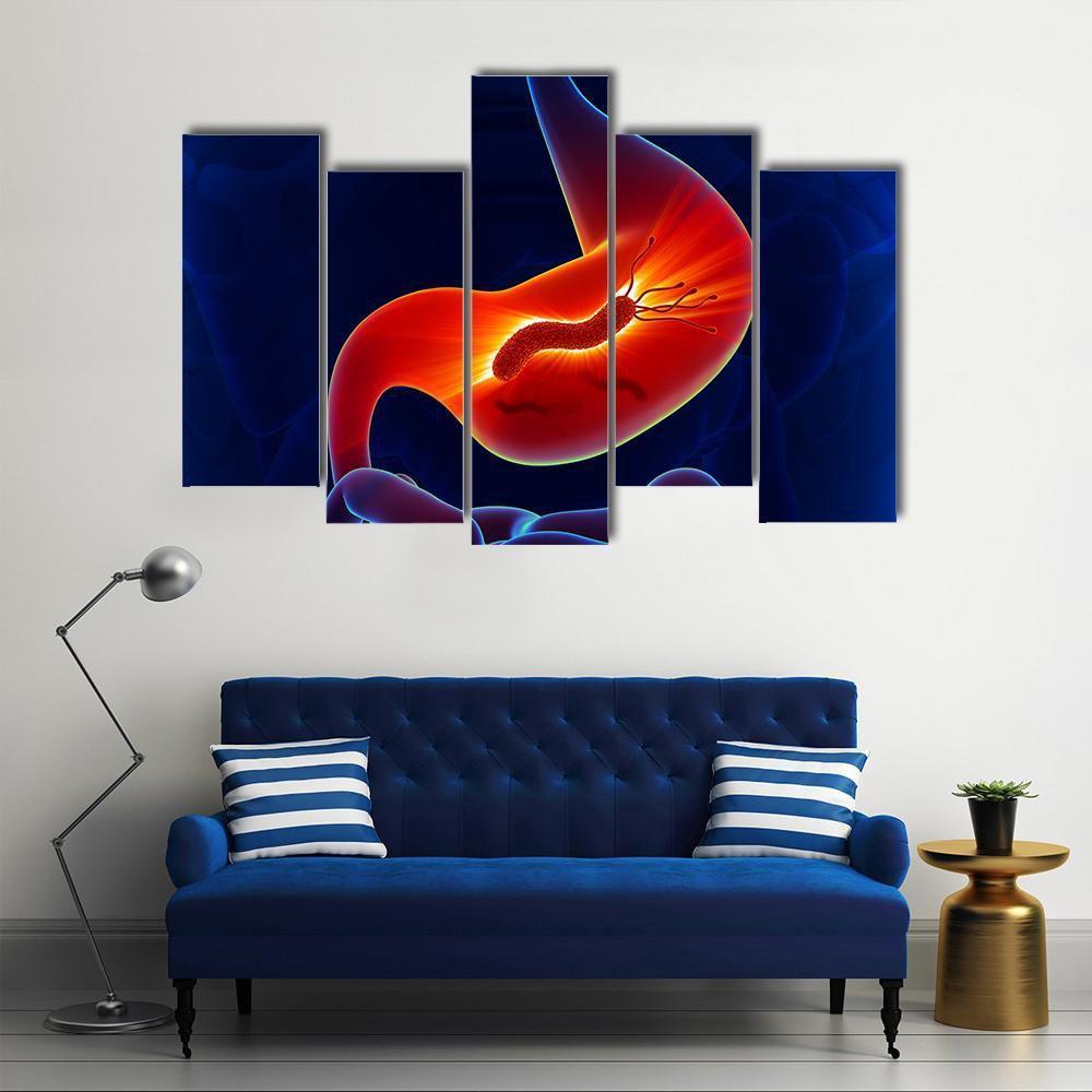 View Of Stomach Canvas Wall Art-5 Pop-Gallery Wrap-47" x 32"-Tiaracle
