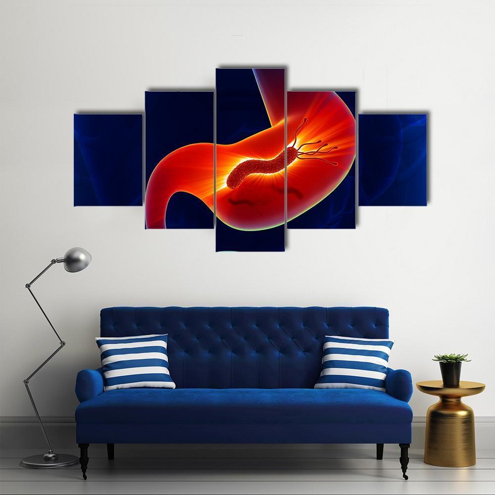 View Of Stomach Canvas Wall Art-5 Star-Gallery Wrap-62" x 32"-Tiaracle