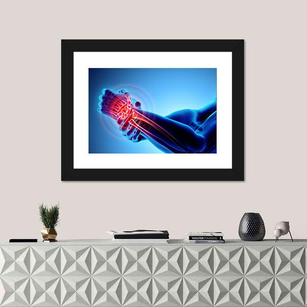 Wrist Painful Skeleton X-Ray Canvas Wall Art-1 Piece-Framed Print-20" x 16"-Tiaracle