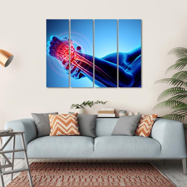 Wrist Painful Skeleton X-Ray Canvas Wall Art-4 Horizontal-Gallery Wrap-34" x 24"-Tiaracle