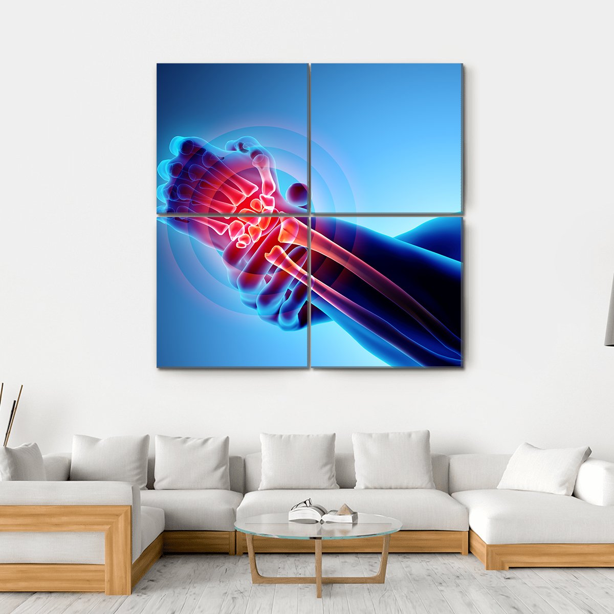 Wrist Painful Skeleton X-Ray Canvas Wall Art-4 Square-Gallery Wrap-17" x 17"-Tiaracle