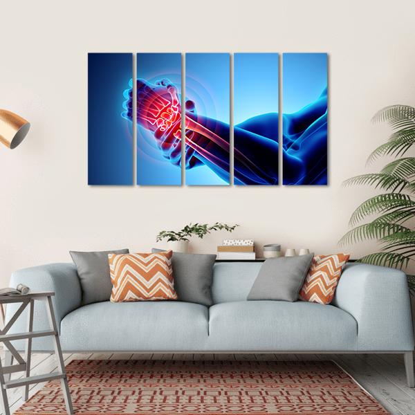 Wrist Painful Skeleton X-Ray Canvas Wall Art-5 Horizontal-Gallery Wrap-22" x 12"-Tiaracle