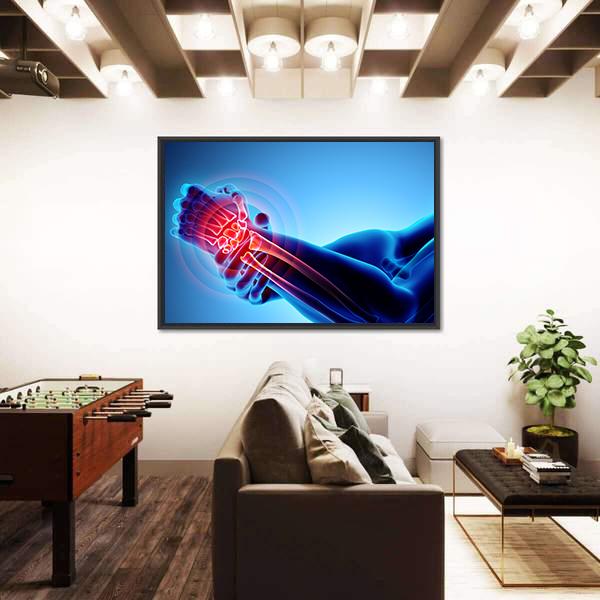 Wrist Painful Skeleton X-Ray Canvas Wall Art-5 Horizontal-Gallery Wrap-22" x 12"-Tiaracle