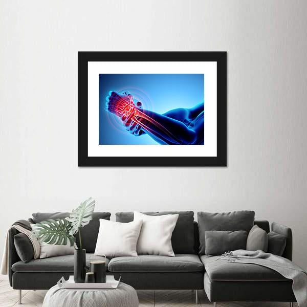 Wrist Painful Skeleton X-Ray Canvas Wall Art-5 Horizontal-Gallery Wrap-22" x 12"-Tiaracle