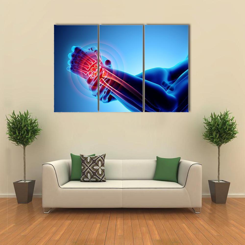 Wrist Painful Skeleton X-Ray Canvas Wall Art-3 Horizontal-Gallery Wrap-37" x 24"-Tiaracle
