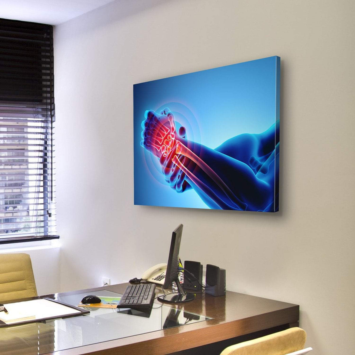 Wrist Painful Skeleton X-Ray Canvas Wall Art-3 Horizontal-Gallery Wrap-25" x 16"-Tiaracle