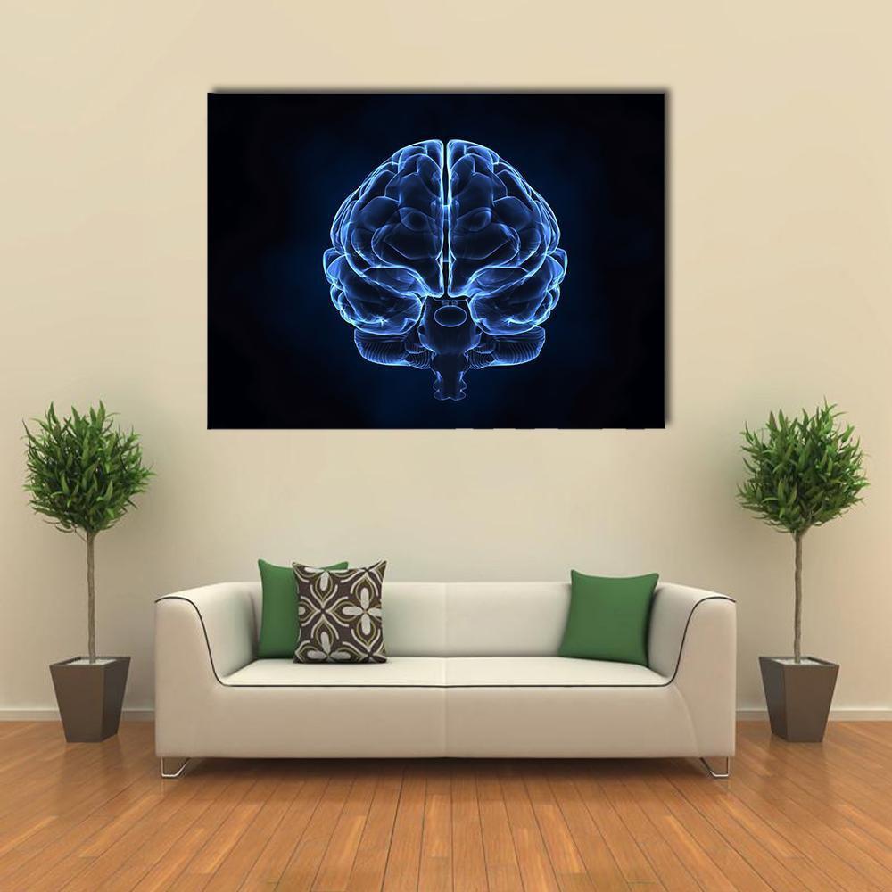 X-Ray Of Human Brain Canvas Wall Art-1 Piece-Gallery Wrap-48" x 32"-Tiaracle