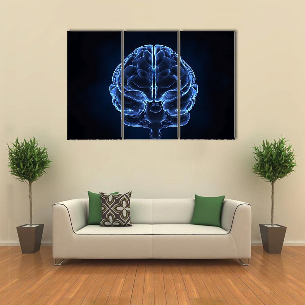 X-Ray Of Human Brain Canvas Wall Art-3 Horizontal-Gallery Wrap-37" x 24"-Tiaracle