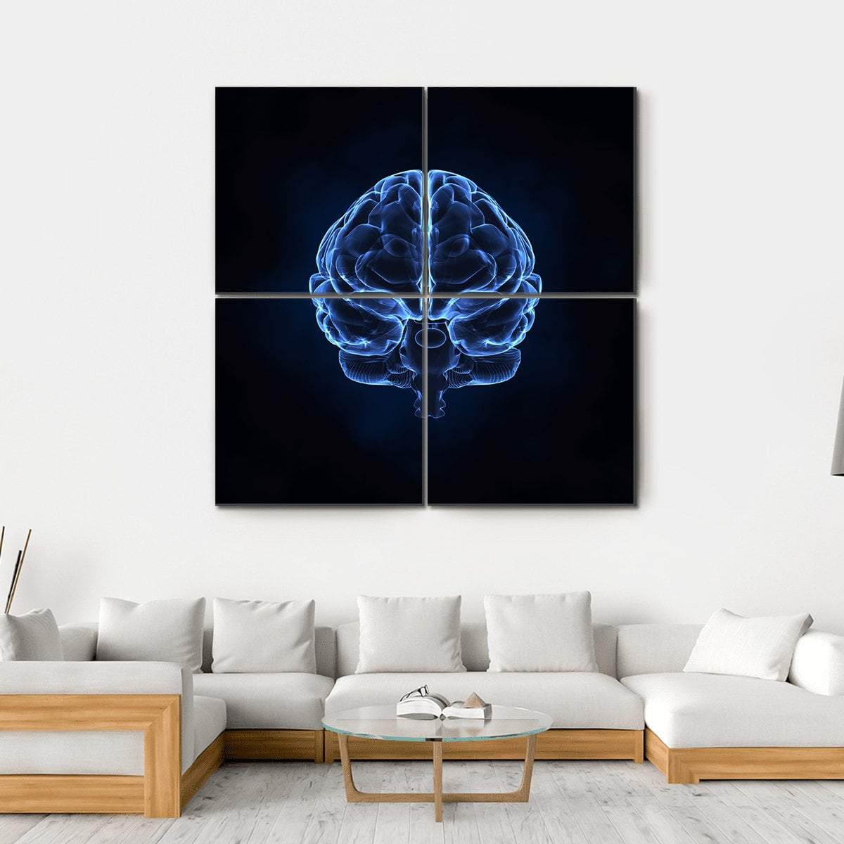 X-Ray Of Human Brain Canvas Wall Art-4 Square-Gallery Wrap-17" x 17"-Tiaracle