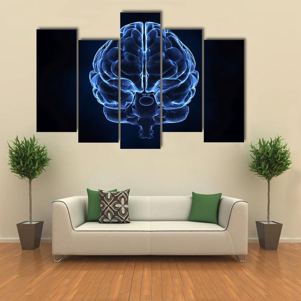 X-Ray Of Human Brain Canvas Wall Art-5 Pop-Gallery Wrap-47" x 32"-Tiaracle