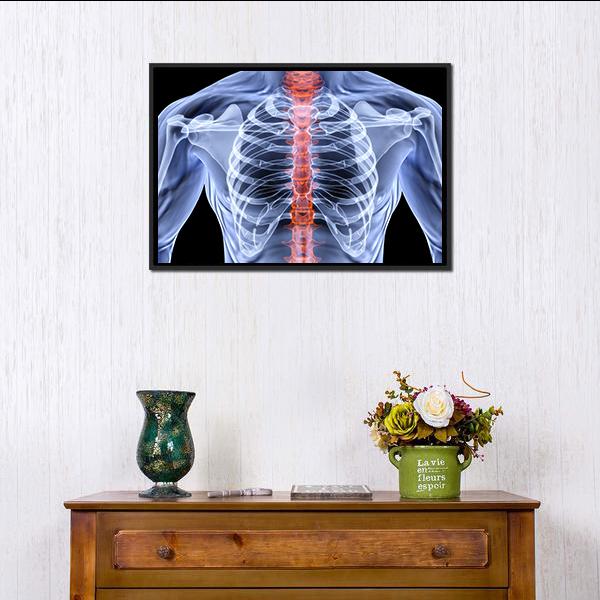 X-Ray Of Men Torso Canvas Wall Art-1 Piece-Floating Frame-24" x 16"-Tiaracle